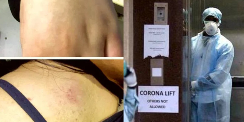 Corona Racism: Northeast Indian Girl Brutally Beaten in India